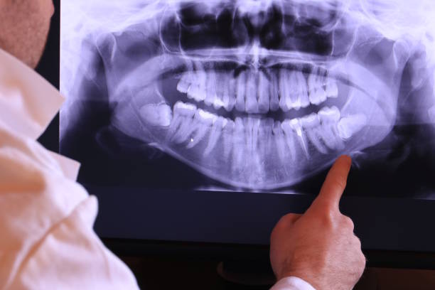 Best Emergency Dental Surgery in Oronogo, MO