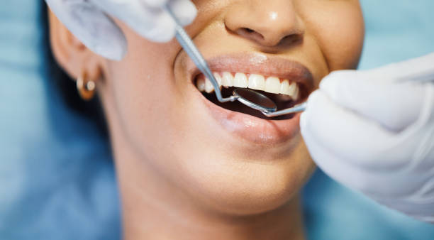 Best Emergency Broken Tooth Repair in Oronogo, MO